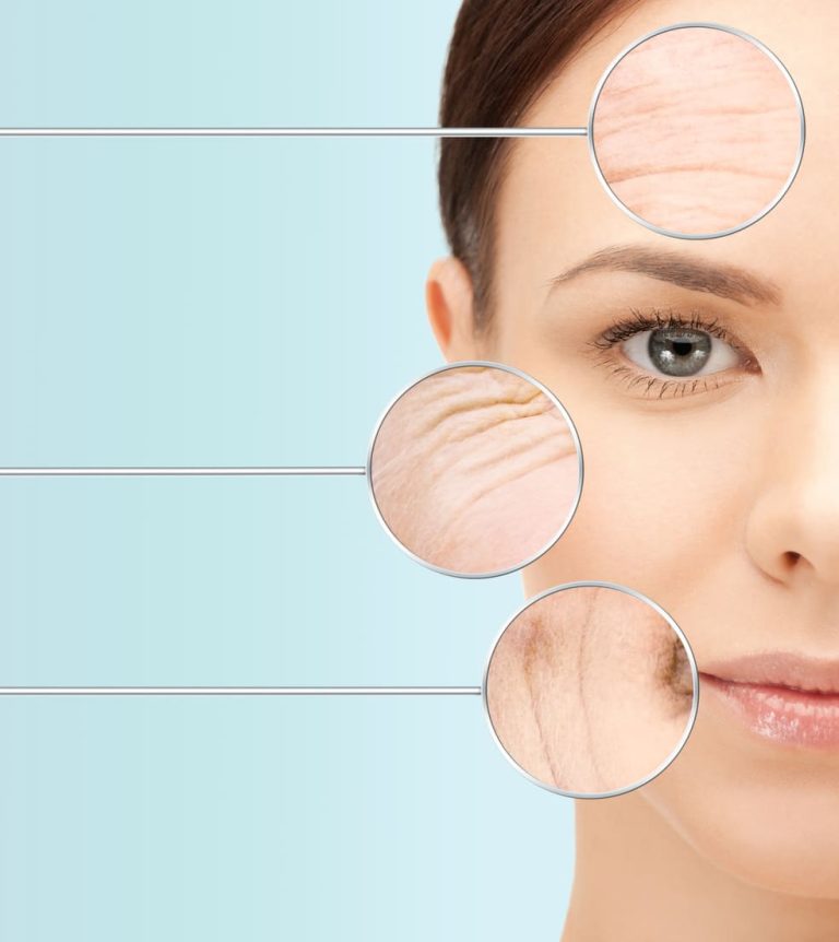 Prevencija prvih bora: Kada i kako početi sa anti-age njegom